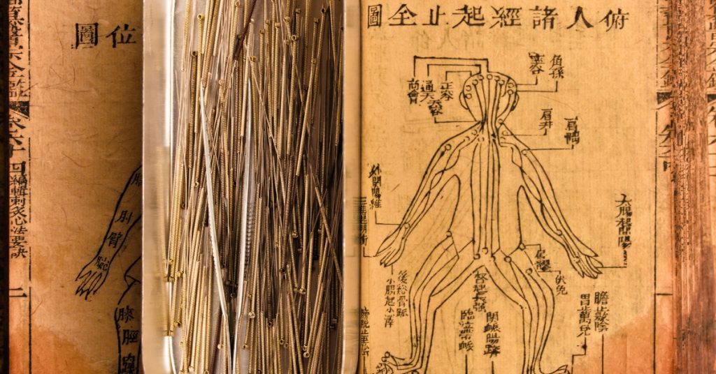 acupuncture vs dry needling