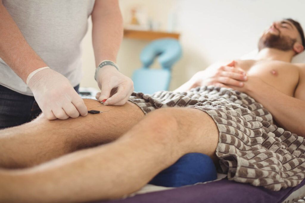 Is Dry Needling Treatment Effective for Sciatica Pain